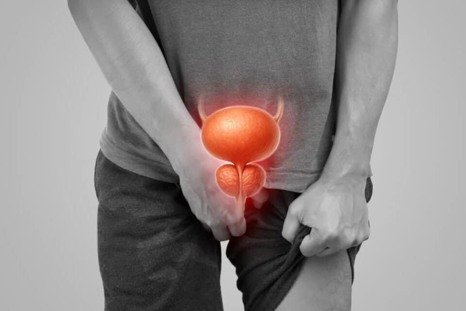 prostatic artery embolization side effects