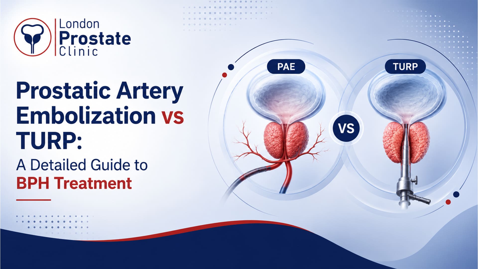 Prostatic Artery Embolization vs TURP: A Detailed Guide to BPH Treatment
